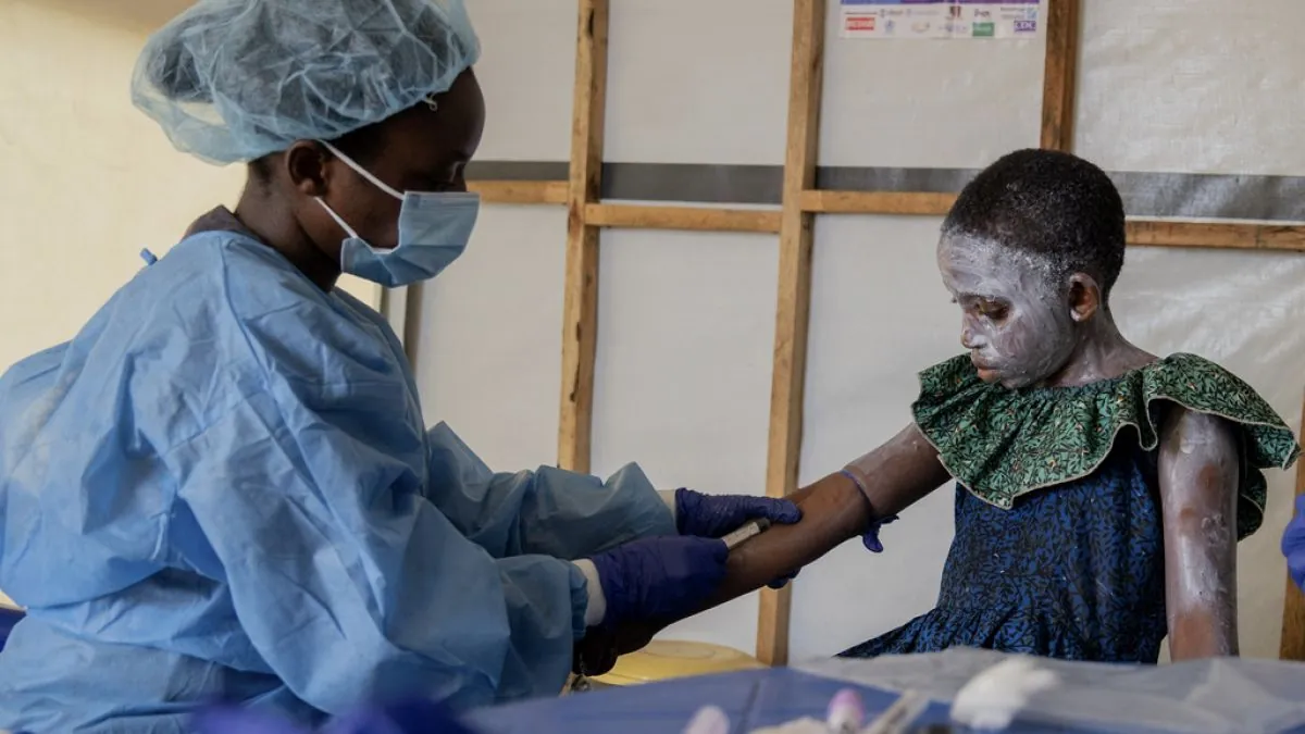 africa-faces-mpox-surge-amid-vaccine-delays-and-new-variant-concerns