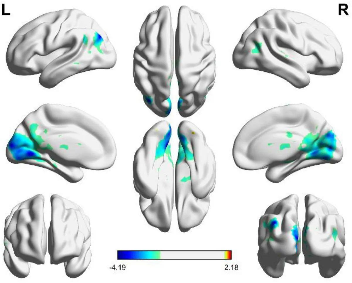 Four Neuroscientists Win $1M Prize for Groundbreaking Visual Research