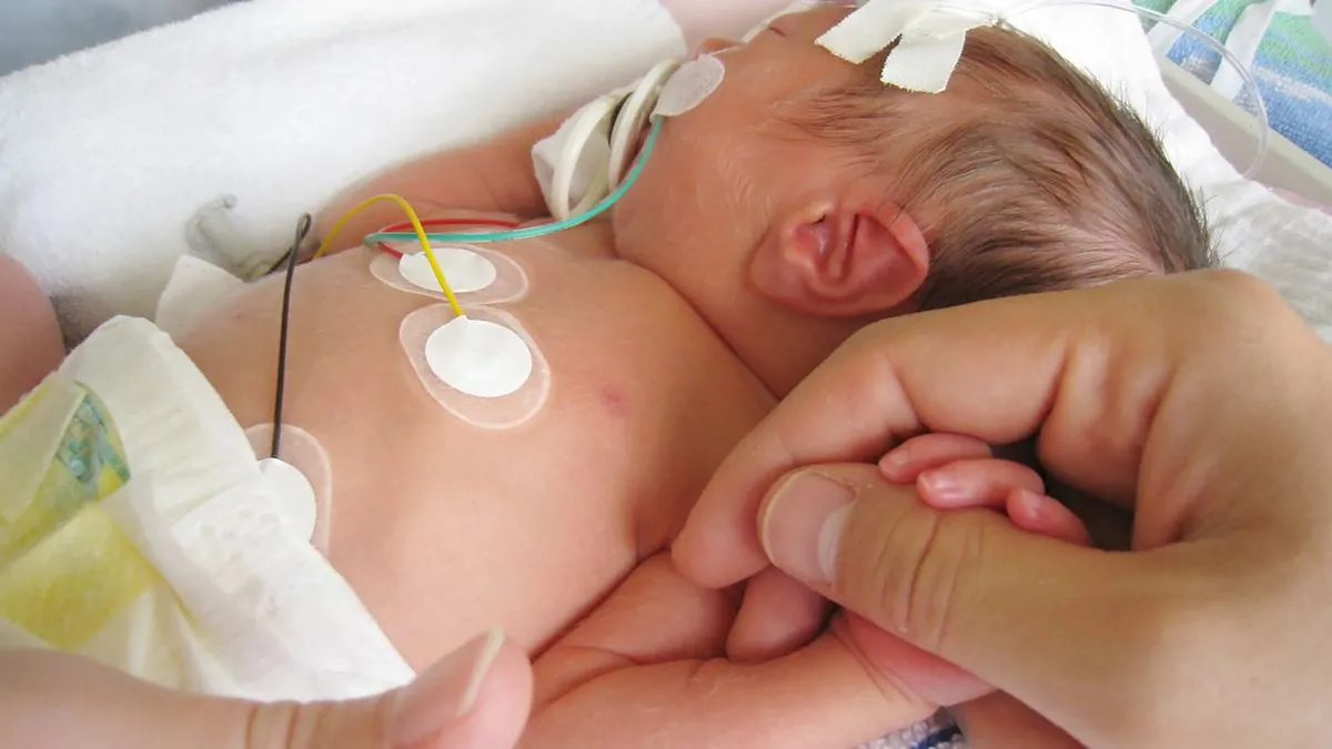 Lawsuit Against Formula Makers and Hospital for Premature Baby's Illness Begins